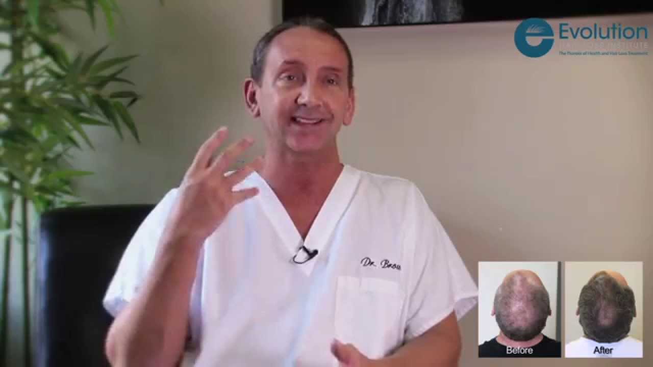 Dr. Steven Brown discussing his results at Evolution Hair Loss Institute