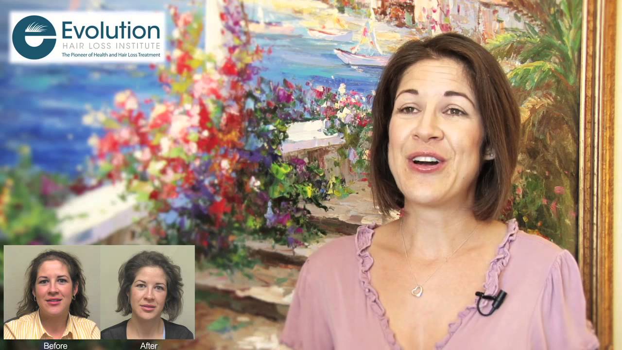 Alicia Flores discusses her Hair Loss Treatment at Evolution Hair Loss Institute